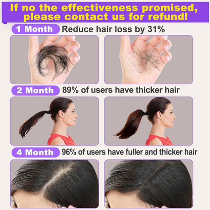 Rosemary Hair Growth Serum 2 Pack with Scalp Massager - Biotin, Argan Oil