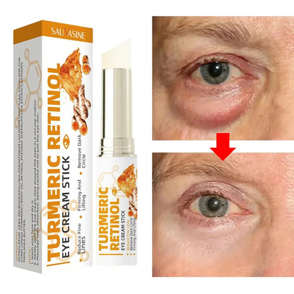 Instant Eye Bag Remove Eye Cream Anti Fat Particles Dark Circles Puffiness Fade Fine Lines Lift Brighten Korean Beauty Eye Care