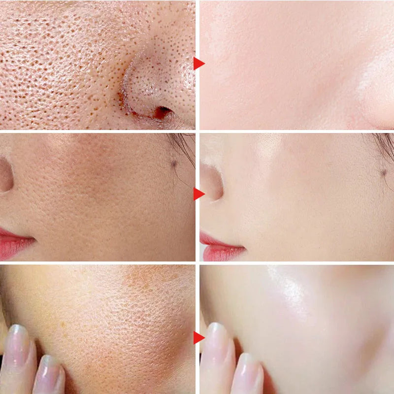 Korean Centella Asiatica Face Serum Shrink Pores Smoothing Rejuvenation Skin Brighten Whitening Cream Facial Moisturizing 30 ml
