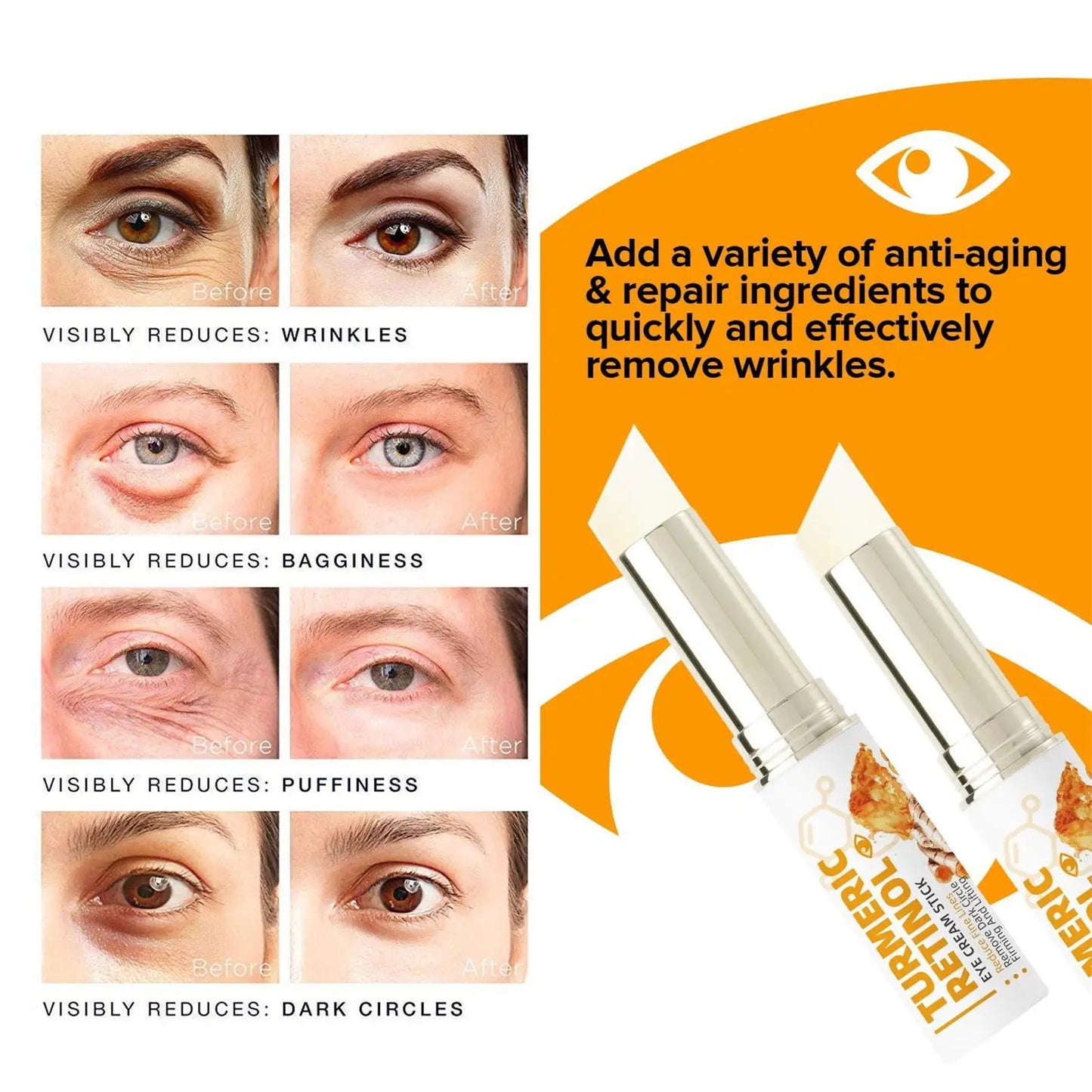 Instant Eye Bag Remove Eye Cream Anti Fat Particles Dark Circles Puffiness Fade Fine Lines Lift Brighten Korean Beauty Eye Care