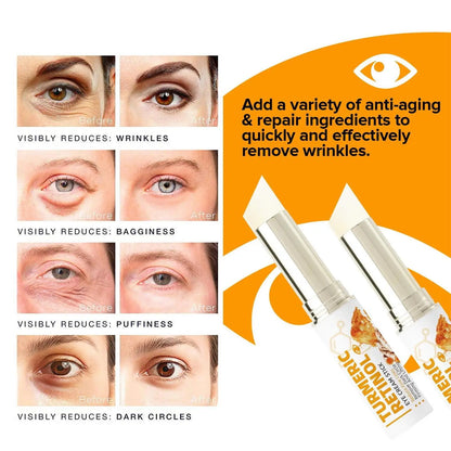 Instant Eye Bag Remove Eye Cream Anti Fat Particles Dark Circles Puffiness Fade Fine Lines Lift Brighten Korean Beauty Eye Care
