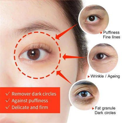 Instant Eye Bag Remove Eye Cream Anti Fat Particles Dark Circles Puffiness Fade Fine Lines Lift Brighten Korean Beauty Eye Care