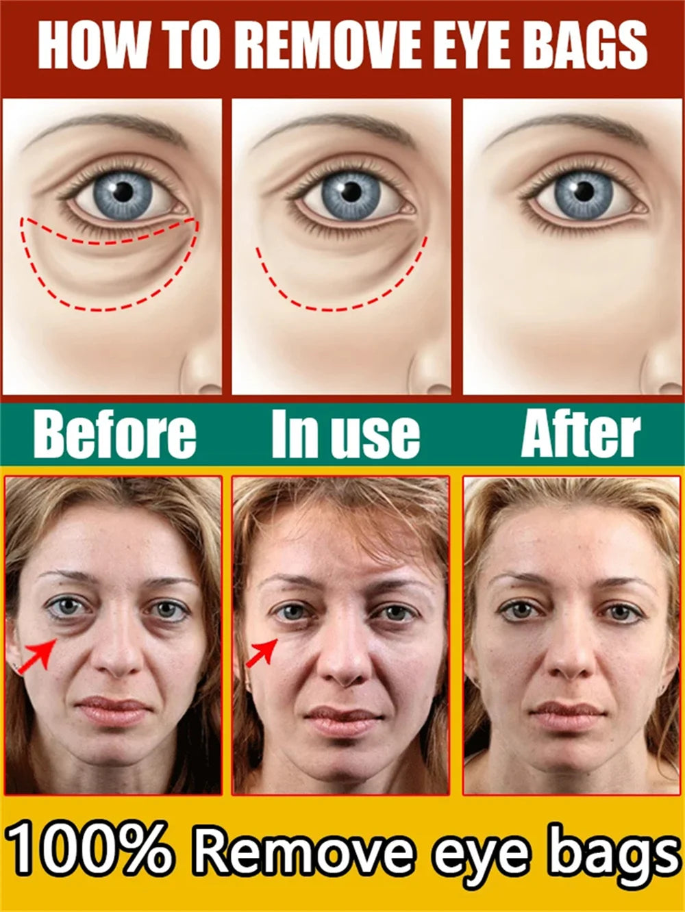 Instant Eye Bag Remove Eye Cream Anti Fat Particles Dark Circles Puffiness Fade Fine Lines Lift Brighten Korean Beauty Eye Care