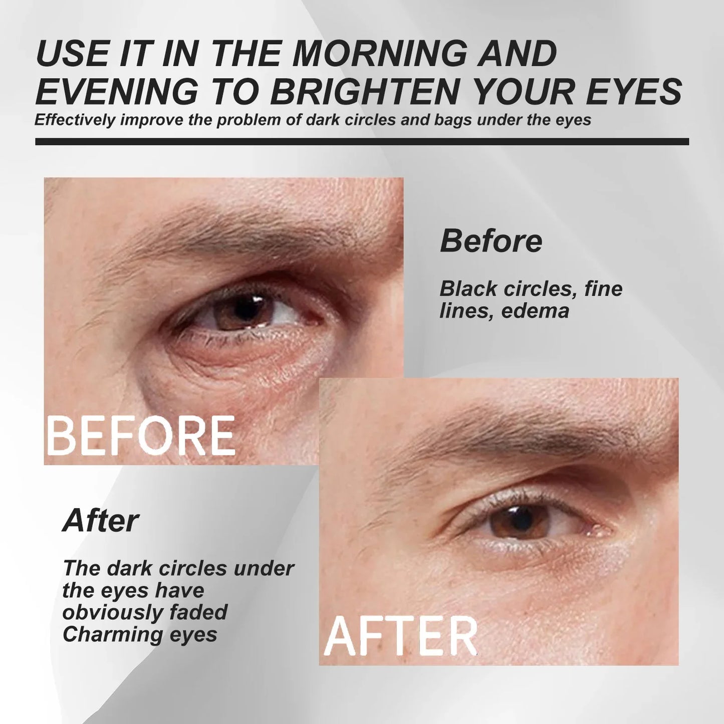 Instant Eye Bag Remove Eye Cream Anti Fat Particles Dark Circles Puffiness Fade Fine Lines Lift Brighten Korean Beauty Eye Care