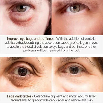 Instant Eye Bag Remove Eye Cream Anti Fat Particles Dark Circles Puffiness Fade Fine Lines Lift Brighten Korean Beauty Eye Care